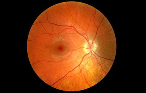 Macula in center of the retina